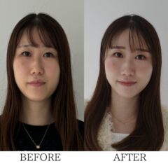 before→After②